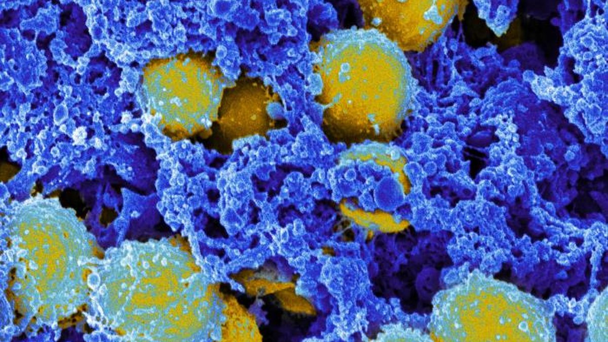 Colorized scanning electron micrograph of Staphylococcus bacteria (gold) embedded in a blue matrix