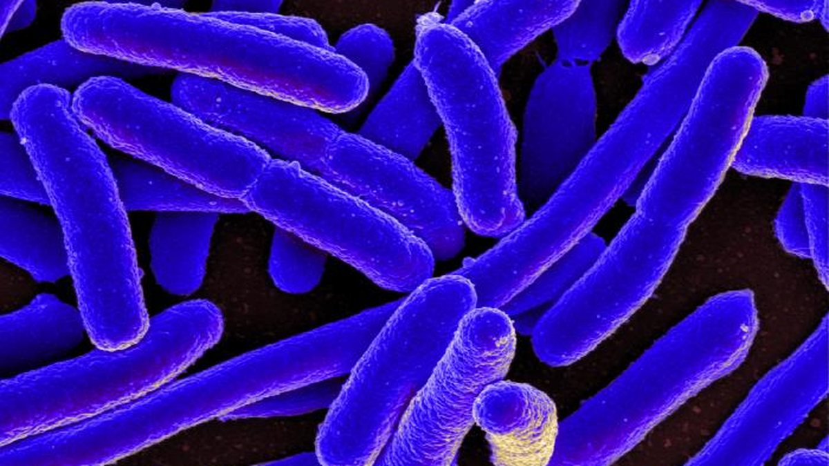 Colorized scanning electron micrograph of rod-shaped Escherichia coli bacteria